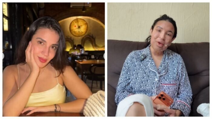 La actriz Patricia Valenzuela narra su proceso de recuperación después de un accidente en su nuevo departamento.